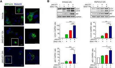 ERK5 Inhibition Induces Autophagy-Mediated Cancer Cell Death by Activating ER Stress